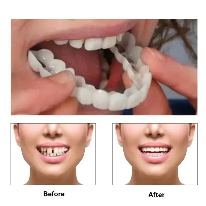 Fake Tooth Cover Perfect Fit T – Beauty Makeup News recenzja i cena